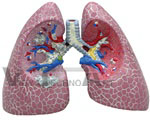 Diseased Lung Anatomical Model